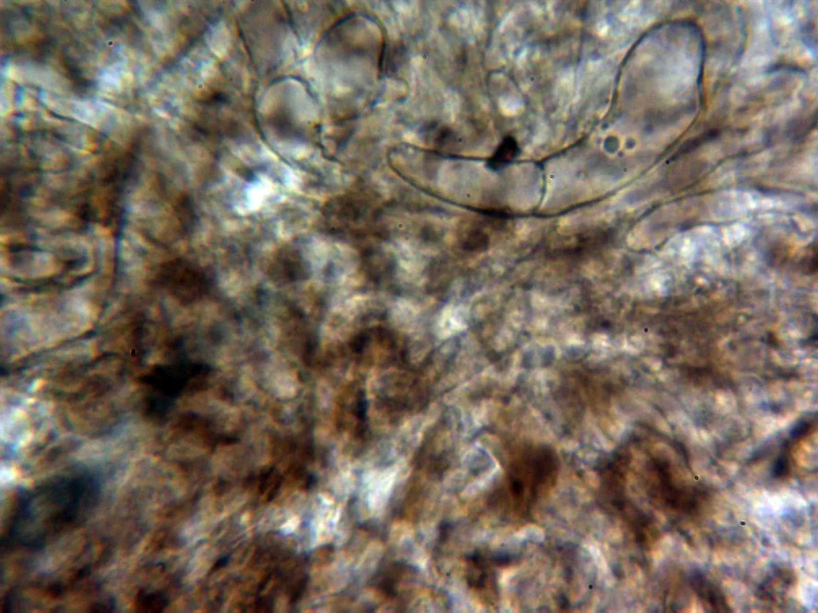 Microscopía de Limacella delicata - 10 - Hifas pigmentadas pileipellis